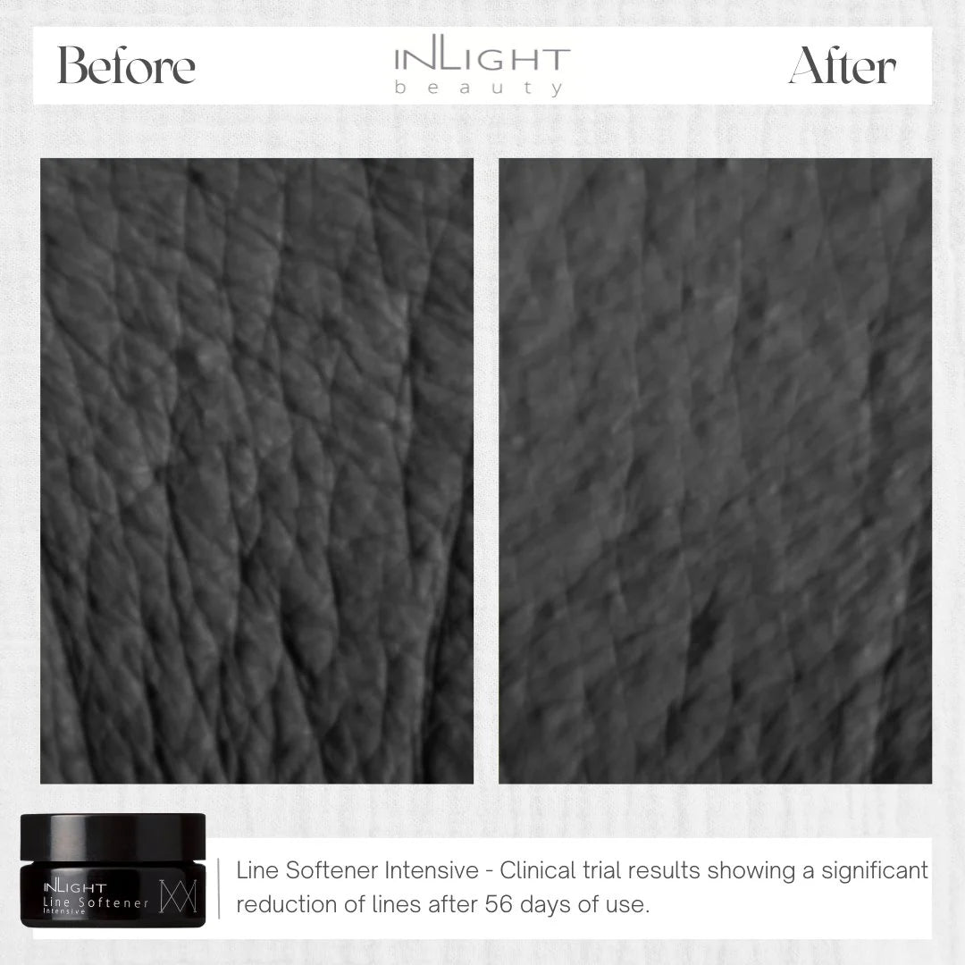 Line Softener Intensive Inlight Beauty