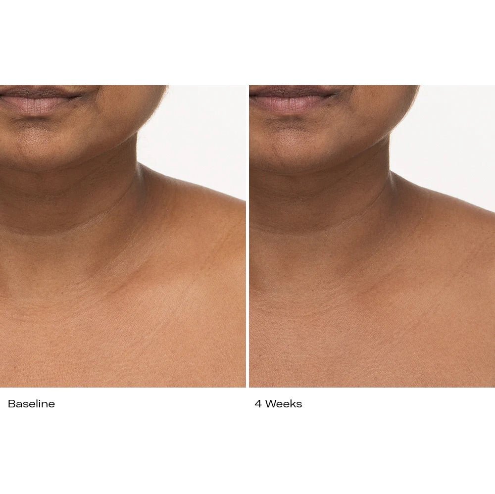 Plumbody - Le Prunier