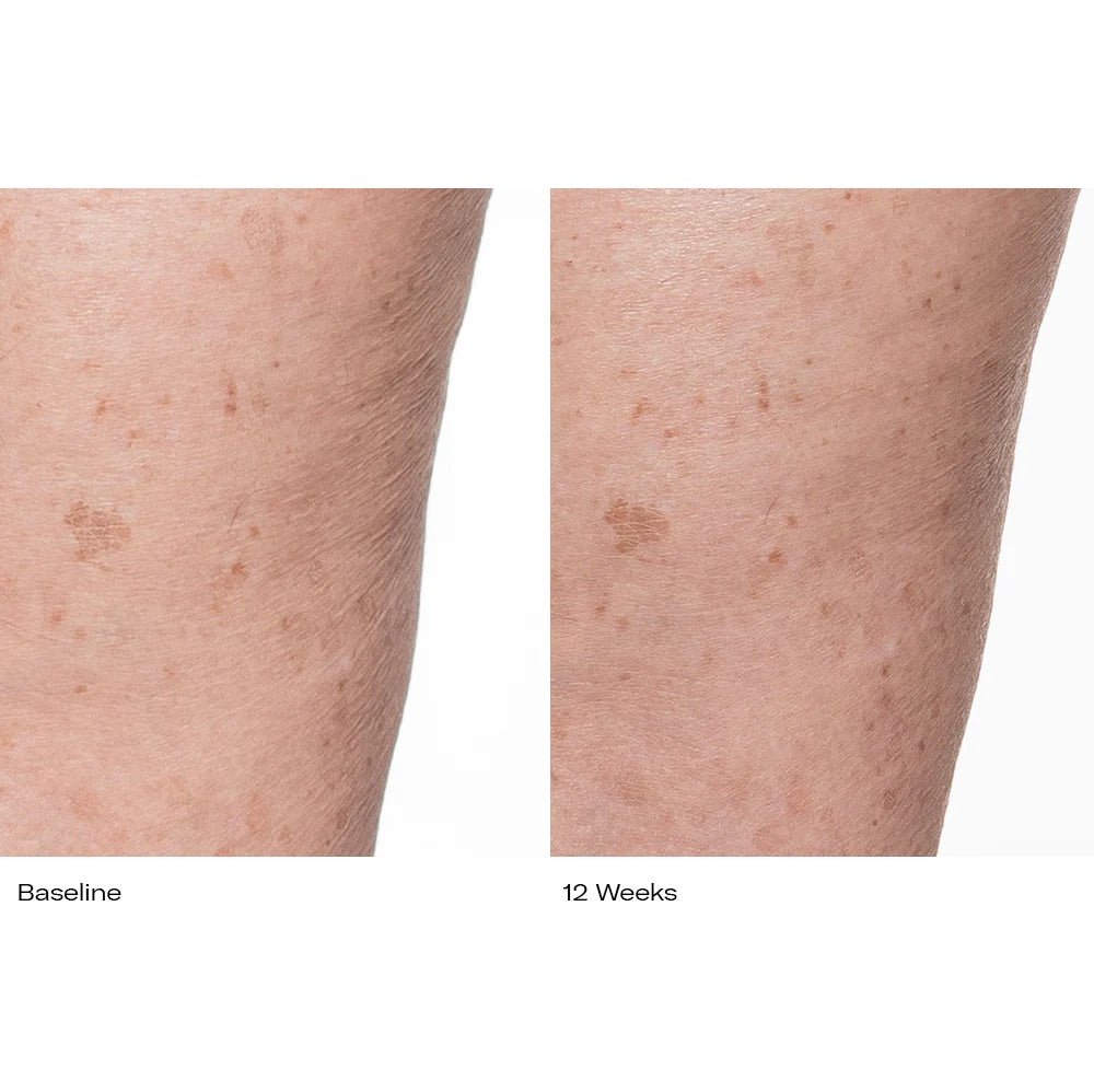 Plumbody - Le Prunier