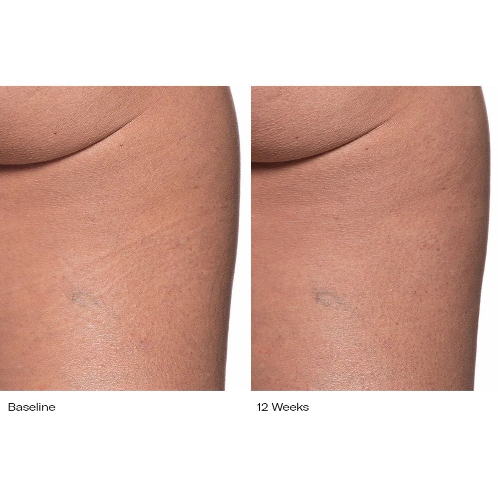 Plumbody - Le Prunier