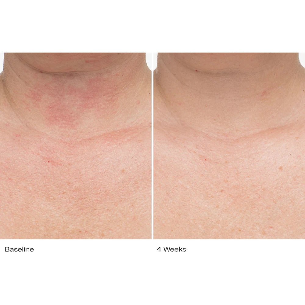 Plumbody - Le Prunier