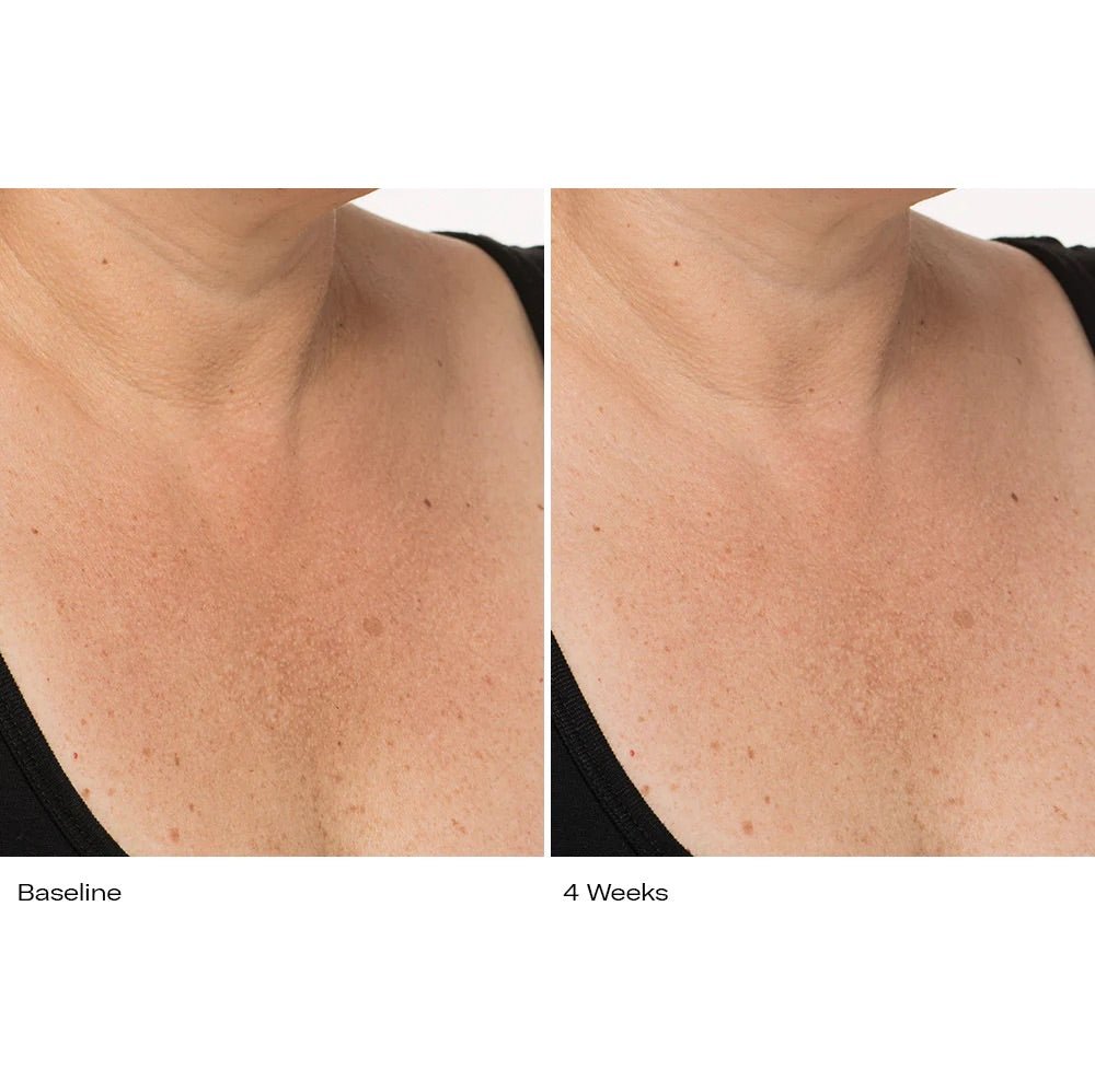 Plumbody - Le Prunier