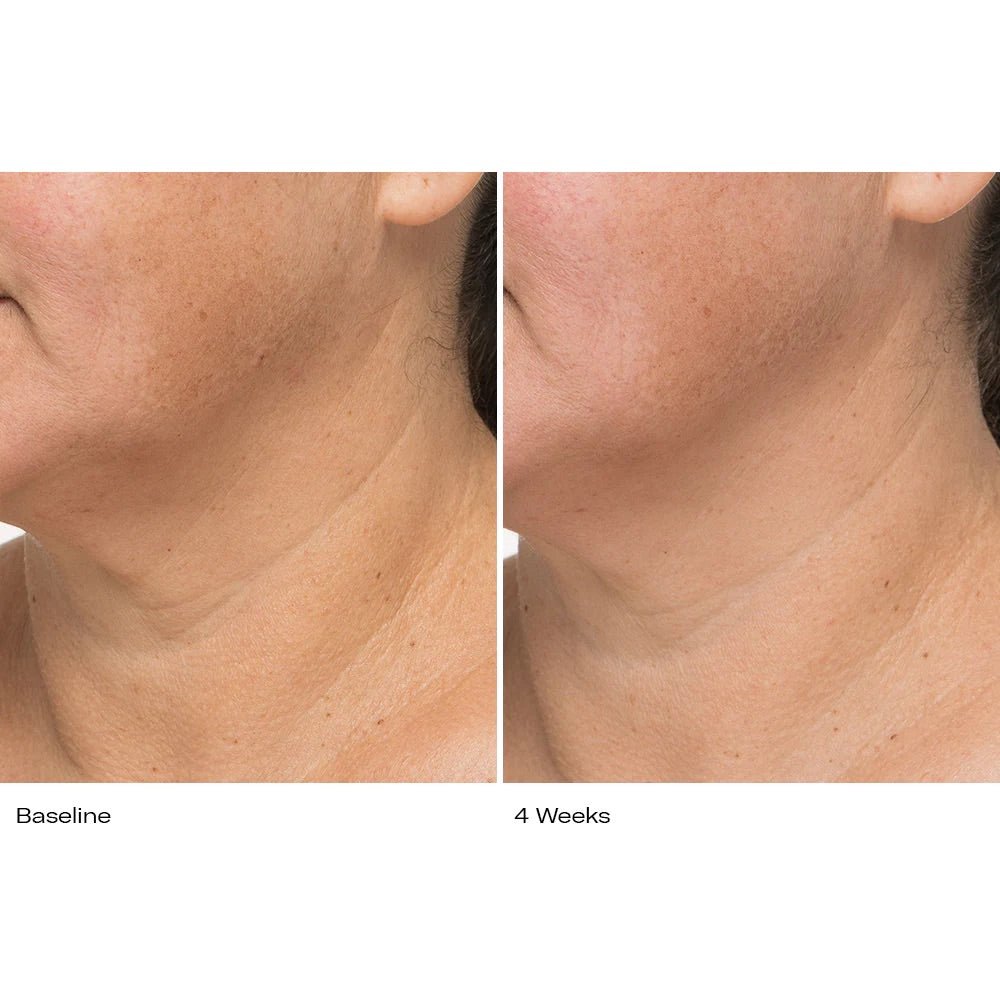 Plumbody - Le Prunier