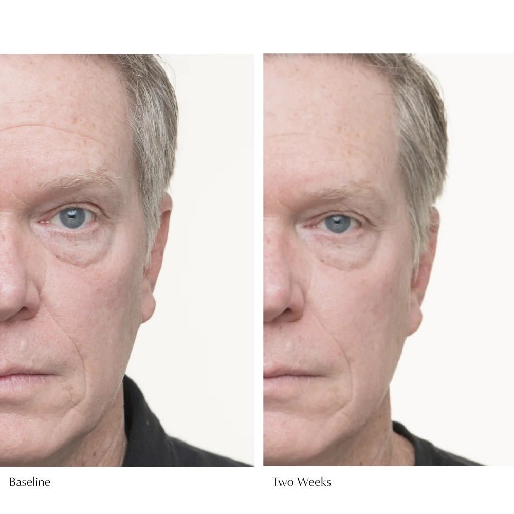 Le Prunier Plumscreen Before and After Man